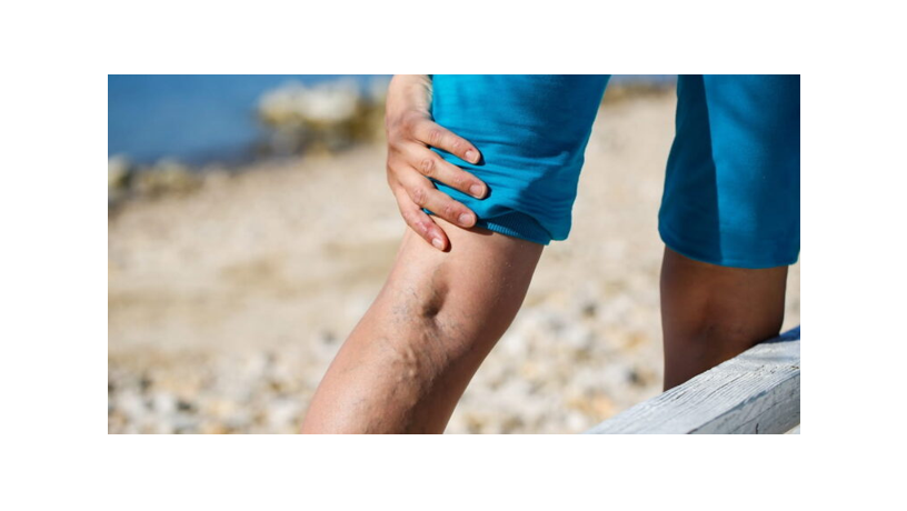 aalag-aldoaly-o-aalag-doal-alsakyn-nhayya-big-0